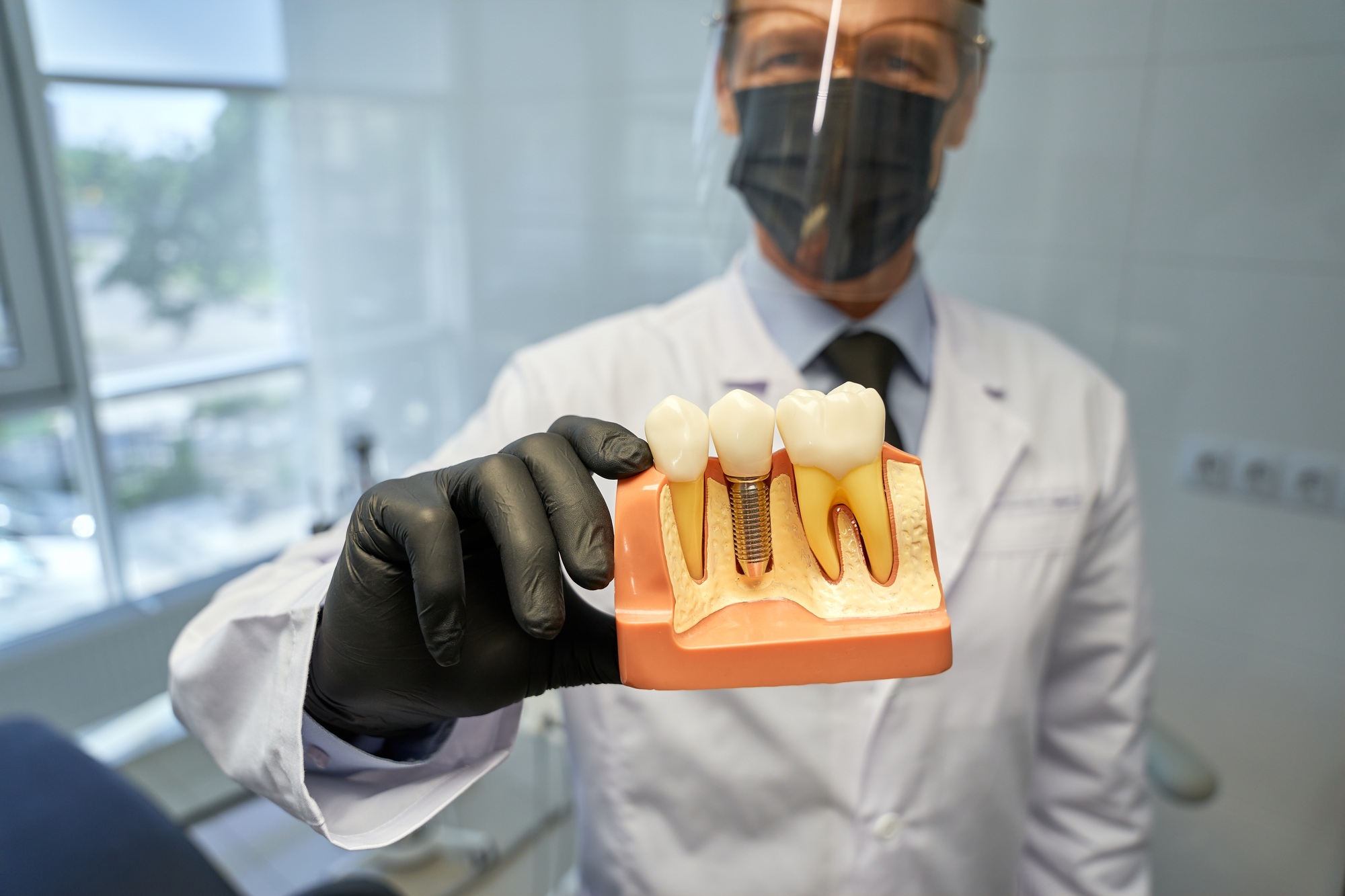 Periodontist holding a dental implant model demonstrating bone graft placement and implant structure at Shady Grove Periodontics in Rockville, MD